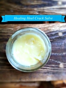 How to Make a Healing Salve for Cracked Heels